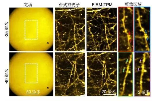 超快光纖激光助力微型雙光子顯微成像系統研究 超快光纖激光助力微型雙光子顯微成像系統研究